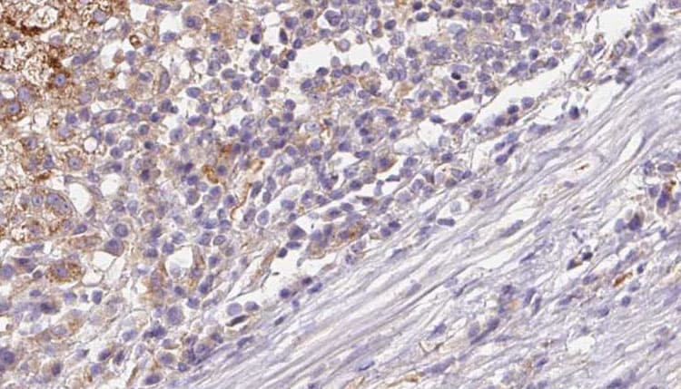 Polyclonal Rabbit anti-Human DNER / BET Antibody (IHC, IF, WB)