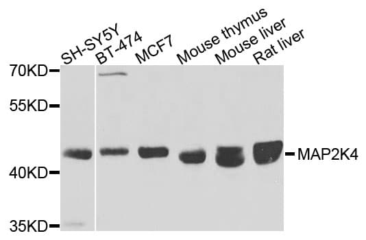 MAP2K4 / MKK4 Antibody (AP)