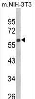 Polyclonal Rabbit anti-Human GDF10 / BMP3B Antibody (aa317-344, WB)