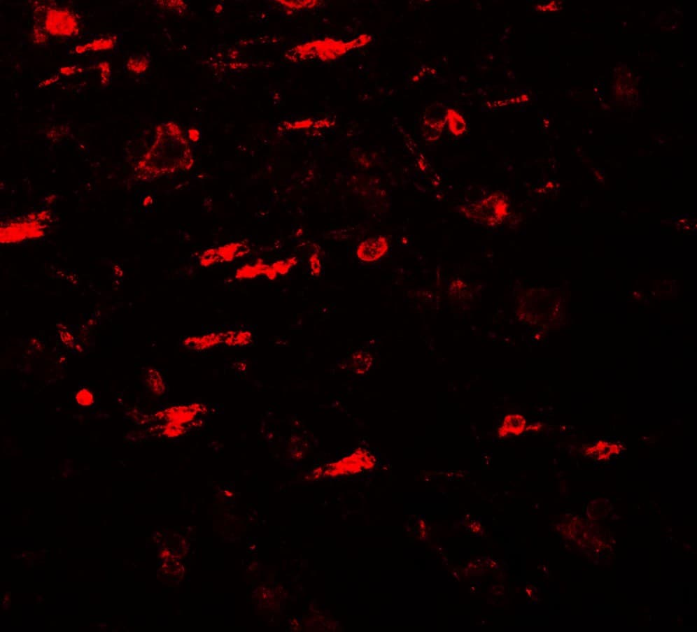 IHC-plus™ ULK4 Antibody