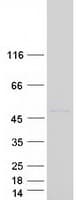 Human CLMP / ACAM Protein (Recombinant Myc-DDK (Flag))