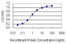 Monoclonal Mouse anti-Human CACNB4 Antibody (clone 7E1, WB)