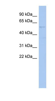 SMYD2 Antibody (C-Terminus)