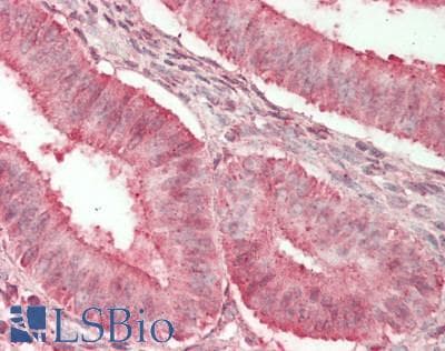 IHC-plus™ Polyclonal Rabbit anti-Human HTR2B / 5-HT2B Receptor Antibody (IHC, WB)