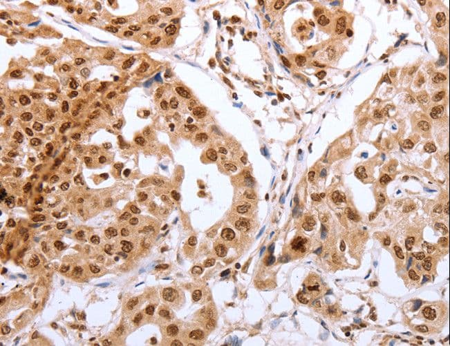 Polyclonal Rabbit anti-Human Securin / PTTG1 Antibody (IHC)