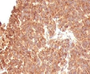 TOP1MT Antibody (clone TOP1MT/488)