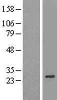 MIS12 Protein (Over-Expression Lysate Myc-DDK (Flag))