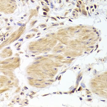 CASP2 / Caspase 2 Antibody
