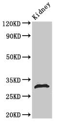Polyclonal Rabbit anti-Human HIST1H1B Antibody (phospho-Ser188, IF, WB)