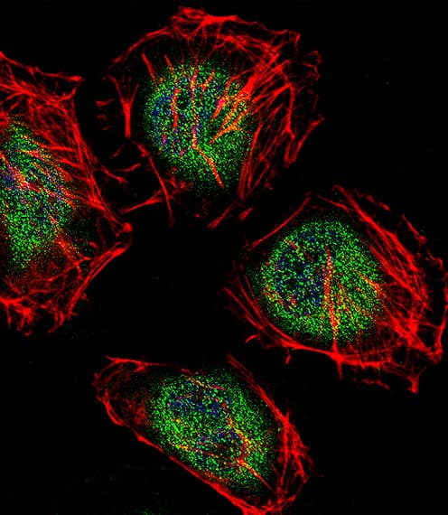 CNOT7 Antibody (aa34-61)
