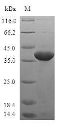 Human TIAF1 Protein (Recombinant GST, N-terminus)