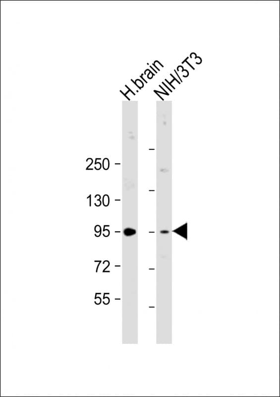 PRKD2 / PKD2 Antibody (Internal)