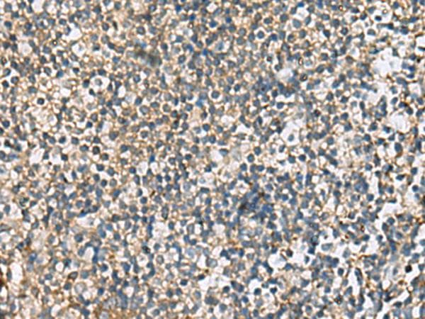 Polyclonal Rabbit anti-Human CXCR5 Antibody (IHC)