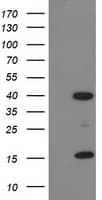 PDLIM2 / SLIM Antibody (clone OTI9A11)