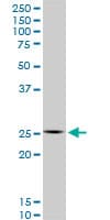 HOXC12 Antibody (clone 1C6)