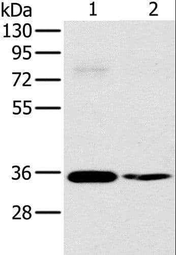 OTUB1 / OTU1 Antibody