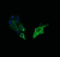 SYP / Synaptophysin Antibody (clone OTI1H9)