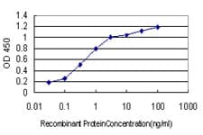 IHC-plus™ Monoclonal Mouse anti-Human TSC22D3 / GILZ Antibody (clone 3A5, IHC, IF, WB)