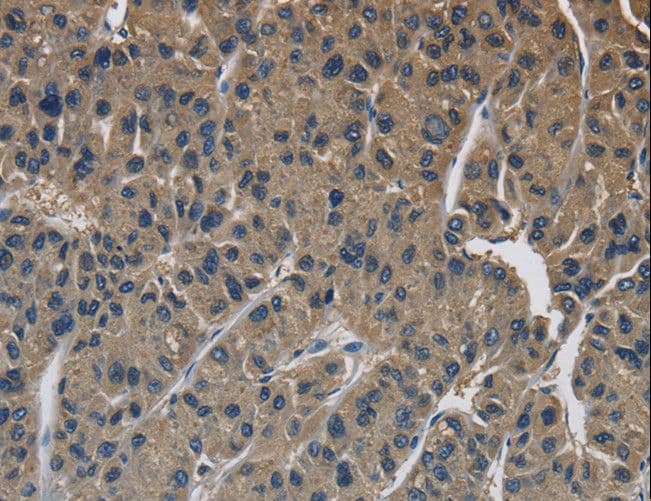 OPRS1 / SIGMAR1 Antibody