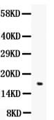 Polyclonal Chicken anti-Human Angiogenin / ANG Antibody (WB)