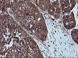 LIMK1 / LIMK Antibody (clone OTI3H6)