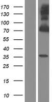 PKG / PRKG1 Protein (Over-Expression Lysate Myc-DDK (Flag))