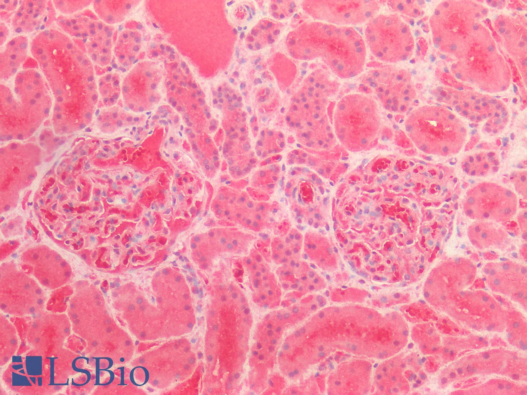 IHC-plus™ Polyclonal Rabbit anti-Human ATG16L1 / ATG16L Antibody (IHC)