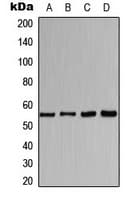 CHRNA1 Antibody (Internal)