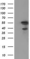 KATNAL1 Antibody (clone OTI6A4)