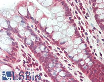 IHC-plus™ TNFRSF11A / RANK Antibody (aa450-500)