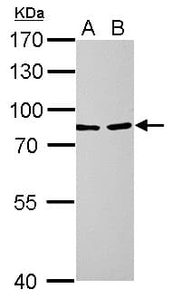 IHC-plus™ LOXL2 Antibody (aa454-742)