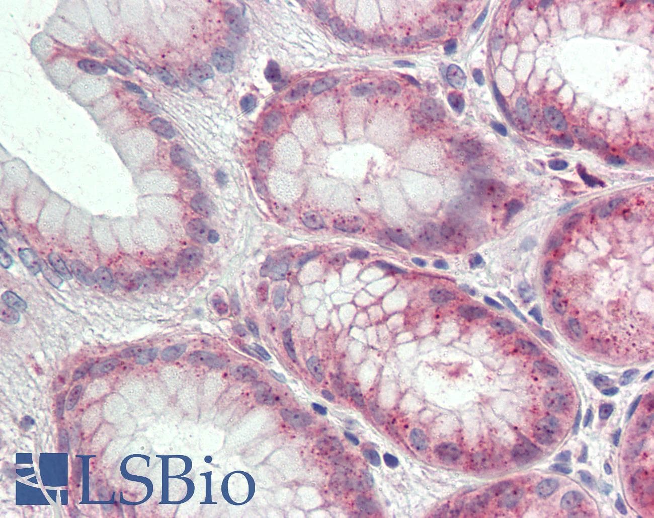 IHC-plus™ ITGA6/Integrin Alpha 6/CD49f Antibody (N-Terminus)