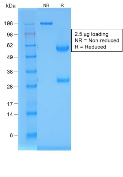 PathPlus™ Recombinant Monoclonal Mouse anti-Human NKX2-1 / Thyroid-Specific TF Antibody (clone rNX2.1/690, IHC)