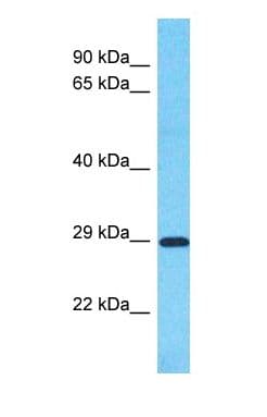 SLC25A35 Antibody (Internal)
