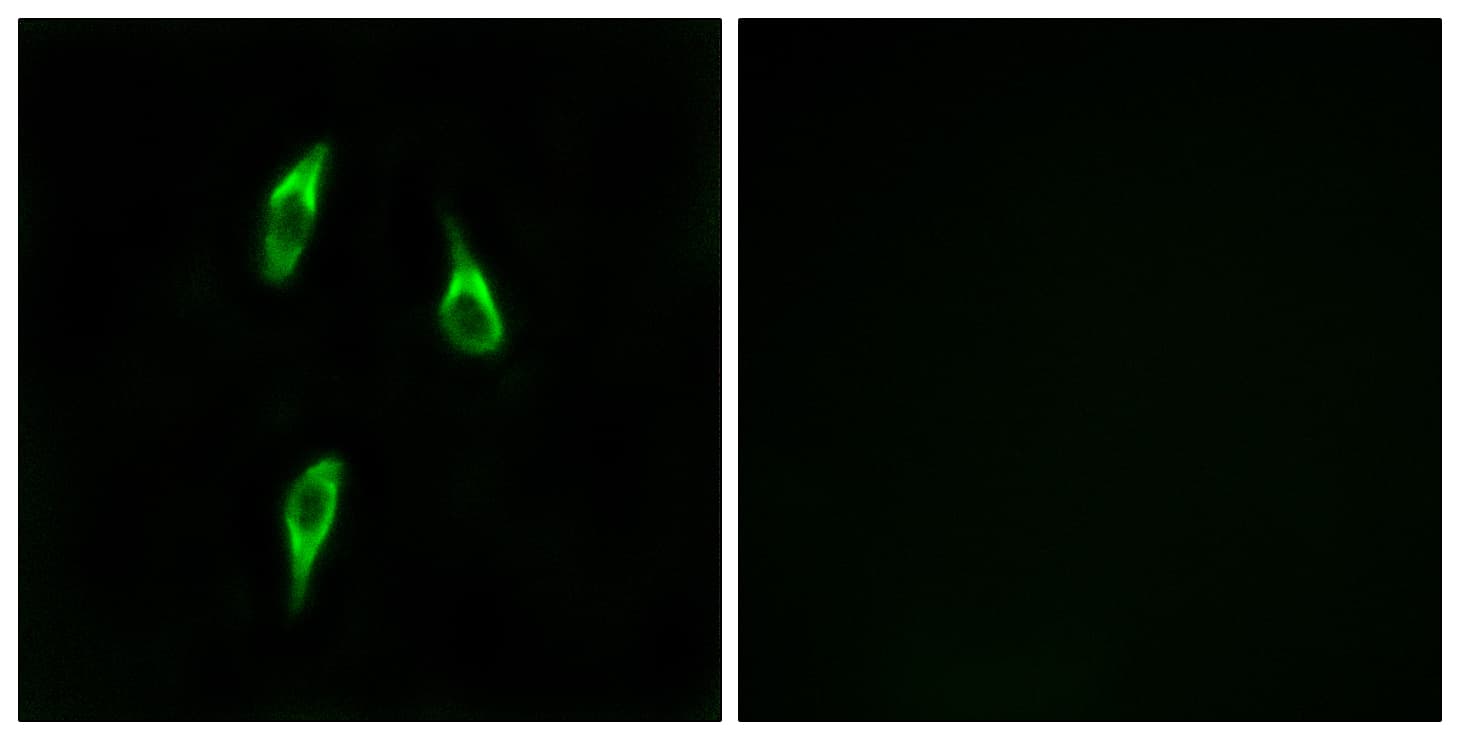OR51B2 Antibody (aa196-245)