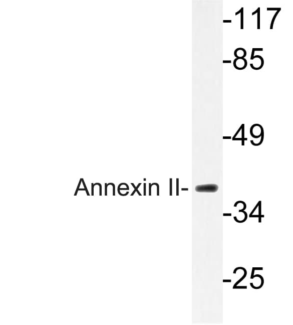 ANXA2 / Annexin A2 Antibody (Asn137)