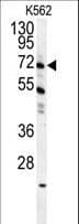 Polyclonal Rabbit anti-Human GAS2L1 Antibody (aa618-646, WB)