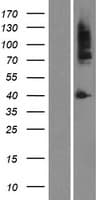 Human AR / Androgen Receptor Protein (Over-Expression Lysate Myc-DDK (Flag))