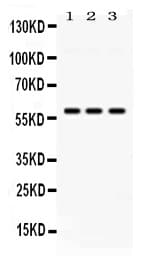 PIAS4 / PIASY Antibody