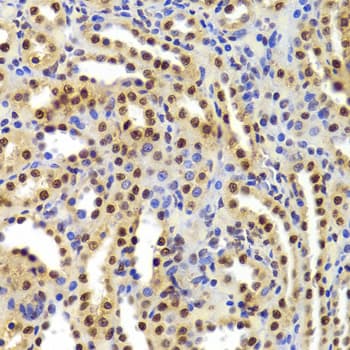 PHAP1 / ANP32A Antibody