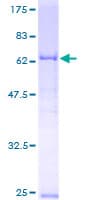 Human BCKDK Protein (Recombinant GST)