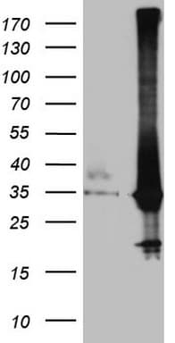 CRP / C-Reactive Protein Antibody (clone OTI1H1, Carrier-free)