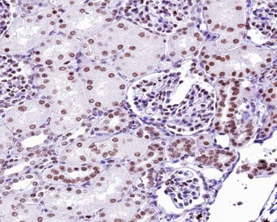 TP53 / p53 Antibody (phospho-Ser9)