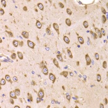 EF1B / EEF1B2 Antibody