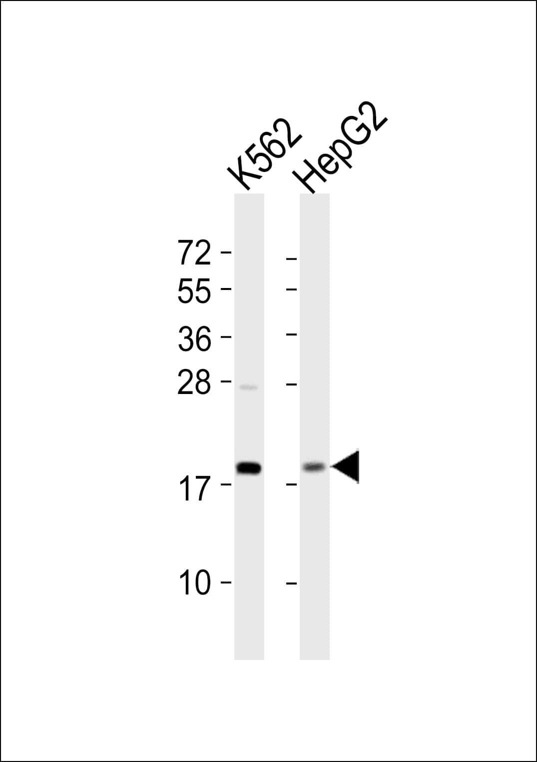 RPS18 / Ribosomal Protein S18 Antibody