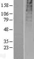 GPR55 Protein (Over-Expression Lysate Myc-DDK (Flag))