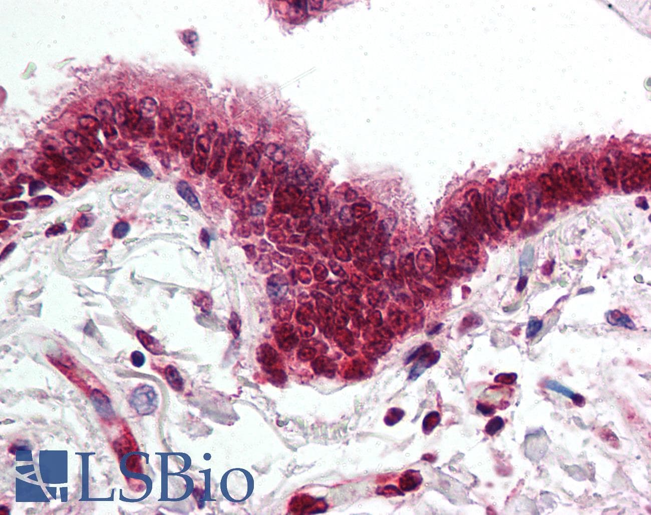 IHC-plus™ SKIL / SNO / SnoN Antibody (aa600-684)
