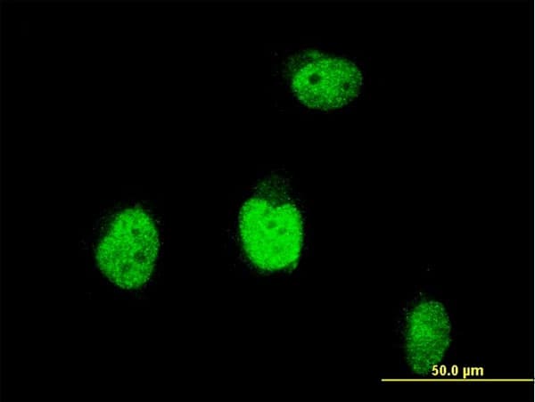 BLM Antibody (clone 1E4)