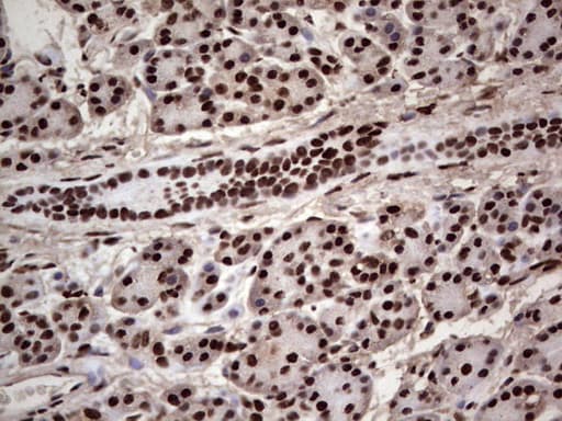 Monoclonal Mouse anti-Human SAE1 Antibody (clone OTI6B11, Carrier-free, IHC, WB)