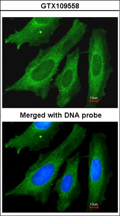 Polyclonal Rabbit anti-Human LRPPRC Antibody (aa611-937, IHC, WB)